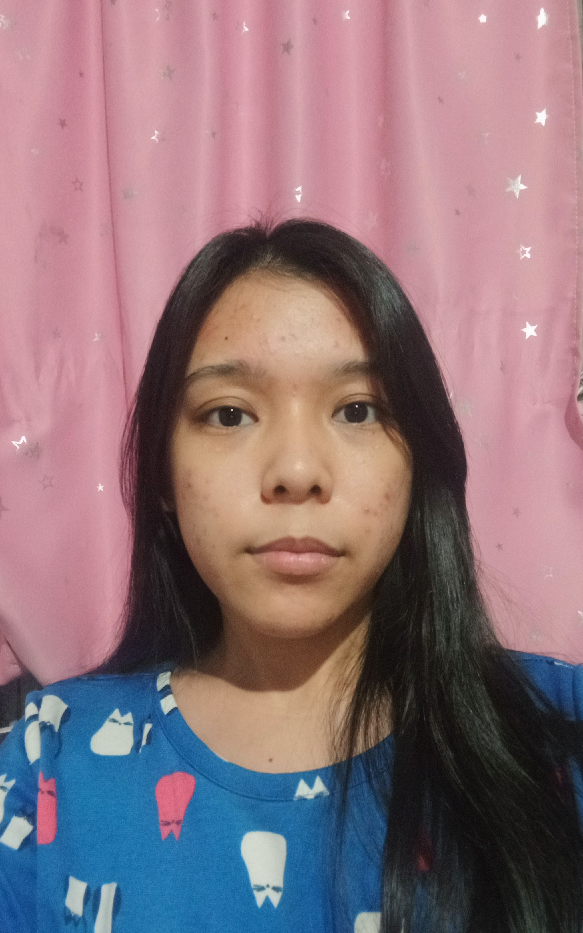 Pimples