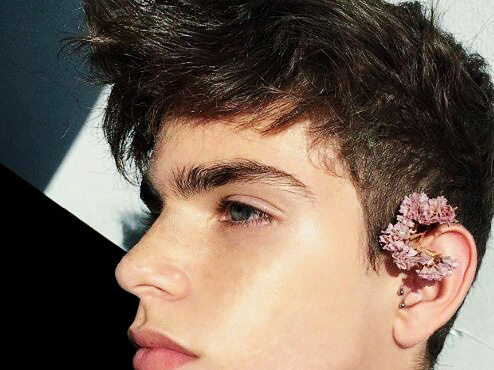 Freckles