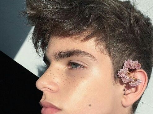 Freckles