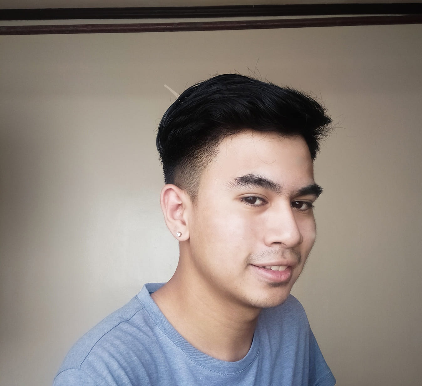 Pimples