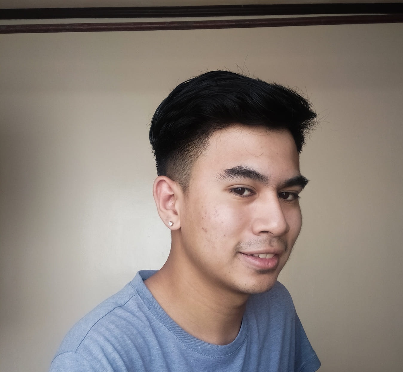 Pimples